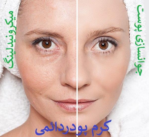 عکس قبل و بعد کرم پودر دائم