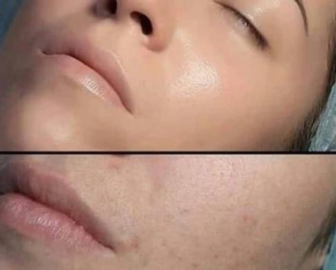 عکس قبل و بعد کرم پودر دائم