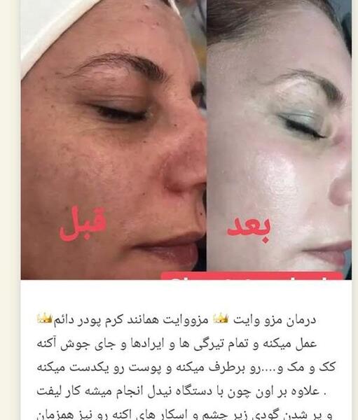 عکس قبل و بعد کرم پودر دائم