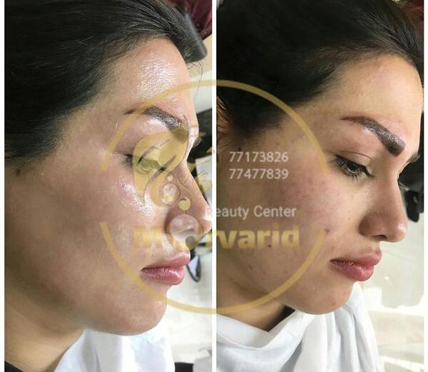 عکس قبل و بعد کرم پودر دائم