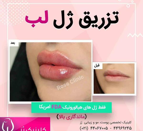 عکس لب قلوه ای طبیعی