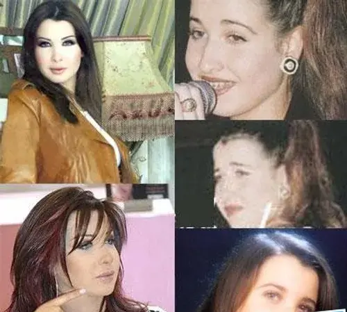 عکس نانسی قبل عمل