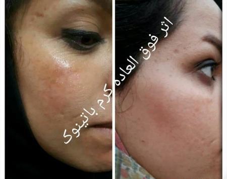 عکس کرم زعفران