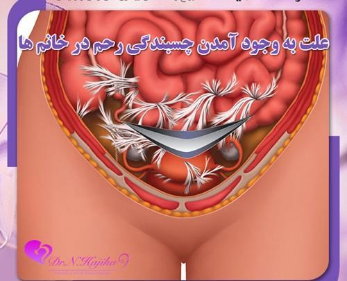 عکس طبیعی داخل رحم