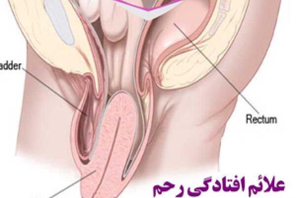 عکس طبیعی داخل رحم