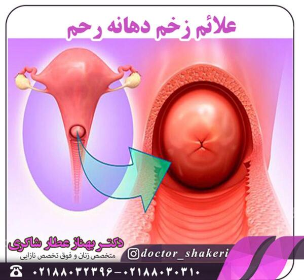 عکس طبیعی داخل رحم