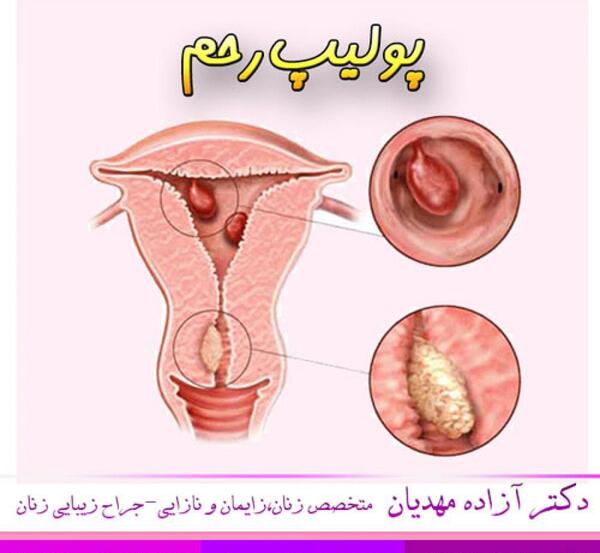 عکس طبیعی داخل رحم