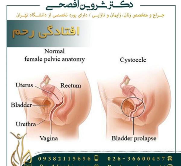عکس طبیعی داخل رحم