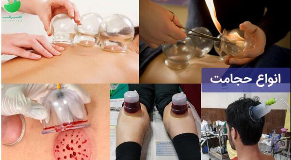 عکس حجامت ریه