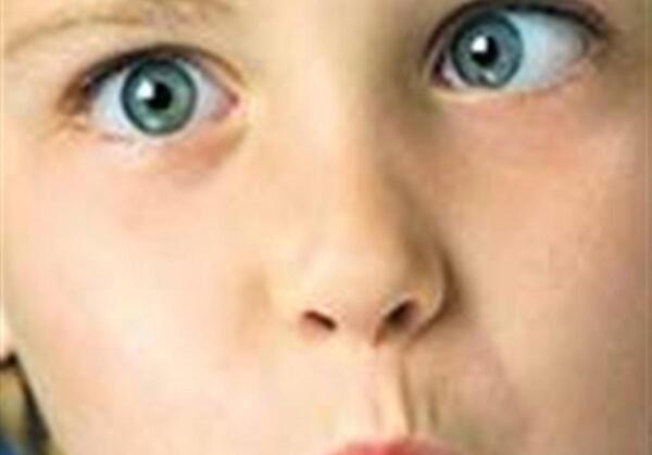 عکس مرد لوچ