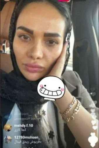 عکس زن قائدی قبل از عمل