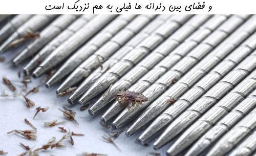 عکس شپش گیر