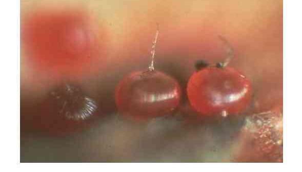 عکس کنه قرمز