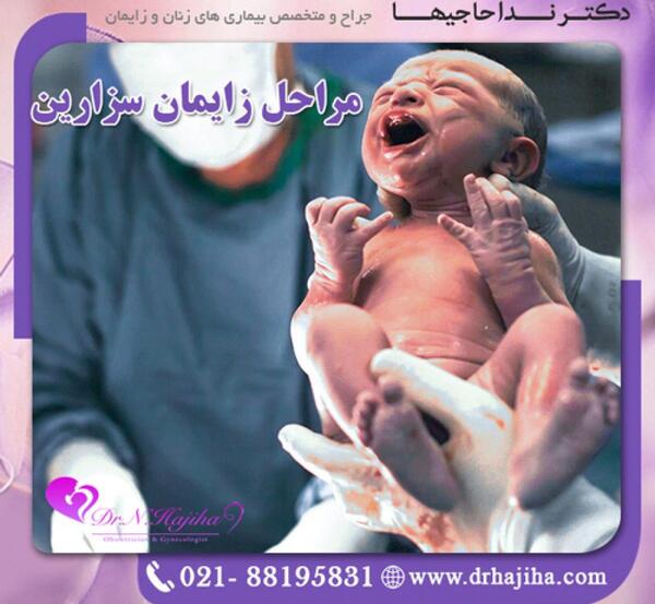 عکس نوزاد دختر در شکم