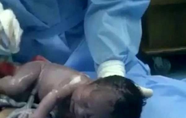 عکس نوزاد دختر در شکم