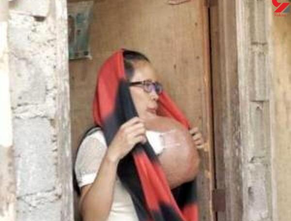 عکس مادر زشت