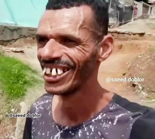 عکس مرد زشت خنده دار