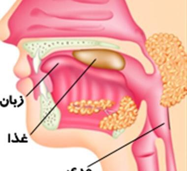 عکس داخل گلو انسان