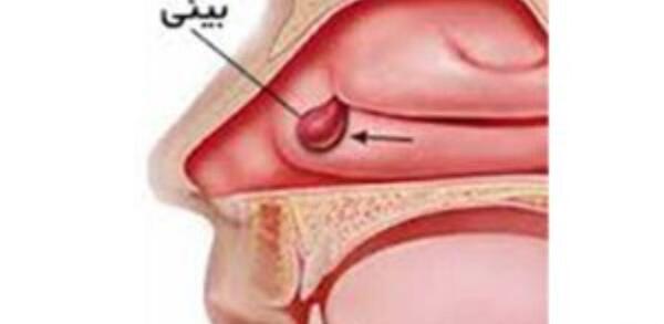 عکس داخل بینی