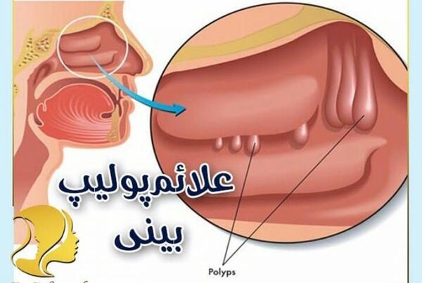عکس داخل بینی