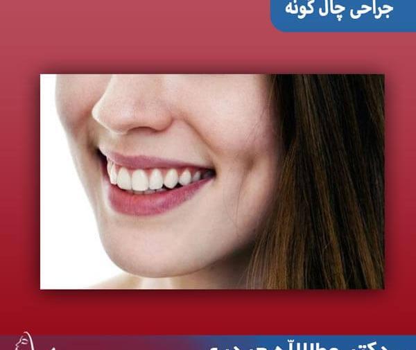 عکس کاشت چال لپ
