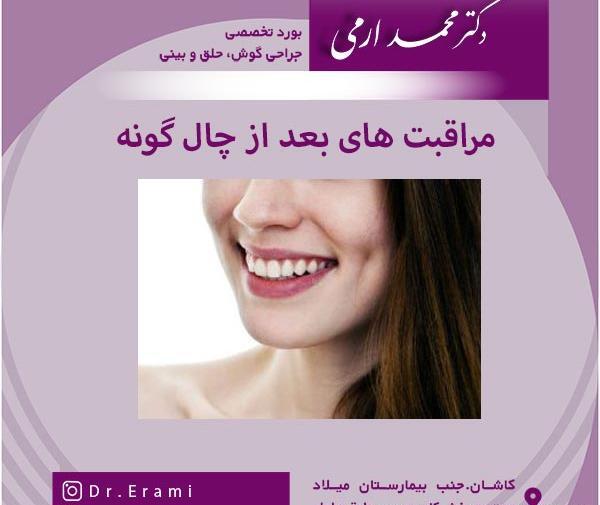 عکس کاشت چال لپ
