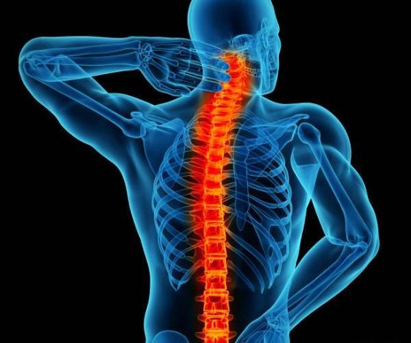 عکس واقعی ستون فقرات
