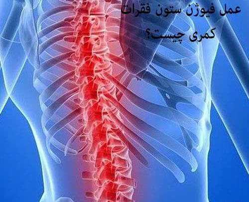 عکس واقعی ستون فقرات
