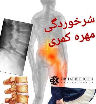 عکس واقعی ستون فقرات