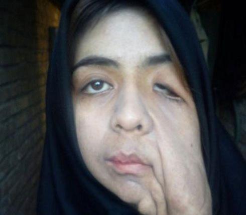 عکس وحشتناک زن