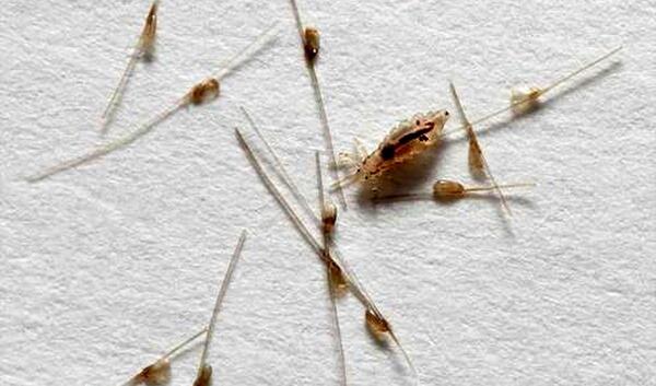 عکس شپش کوچک
