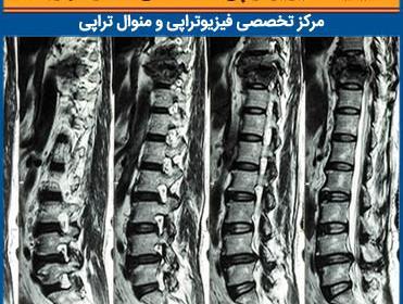 عکس ام ار ای فتق دیسک