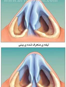 عکس داخل بینی سالم
