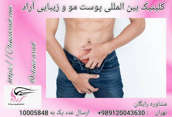 عکس دستگاه لیزر مو زائد