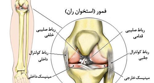 عکس ام ار ای پارگی مینیسک زانو