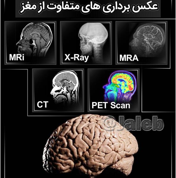 عکس تصویربرداری