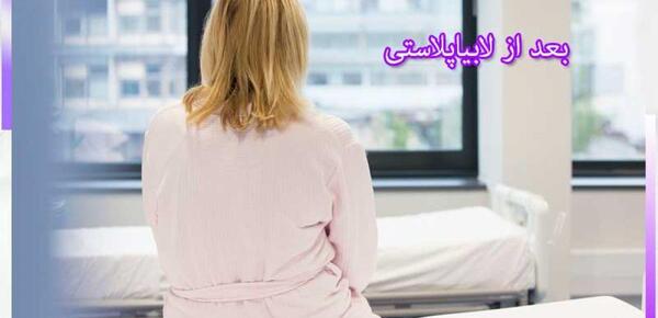 لابیاپلاستی عکس واقعی