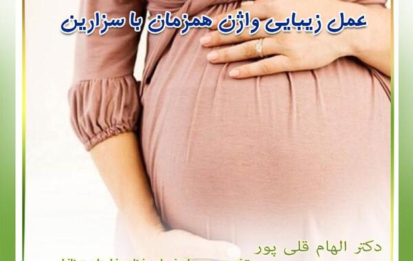 لابیاپلاستی عکس واقعی