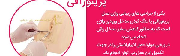 لابیاپلاستی عکس واقعی