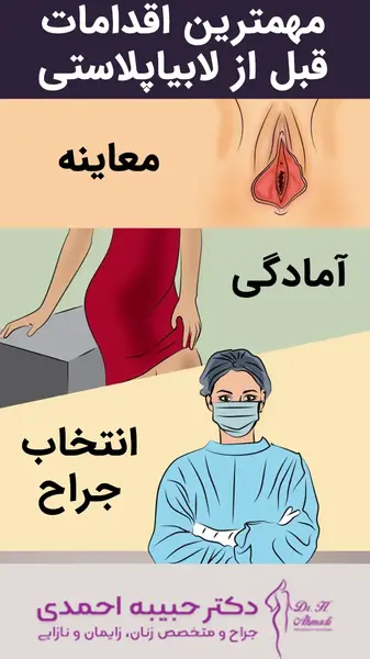 لابیاپلاستی عکس واقعی