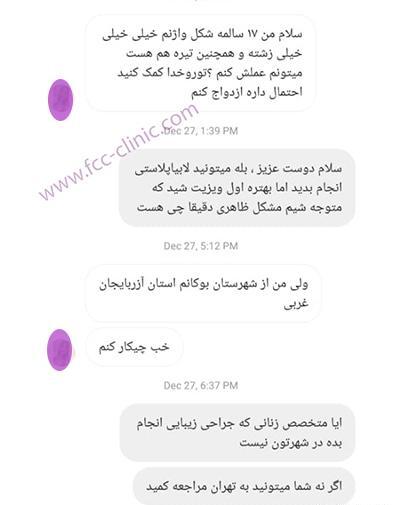 لابیاپلاستی عکس واقعی