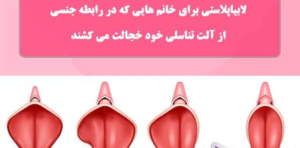 لابیاپلاستی عکس واقعی