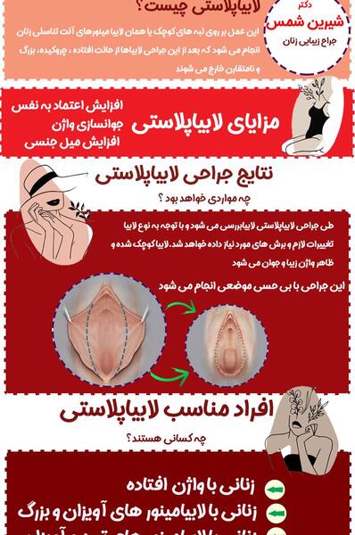 لابیاپلاستی عکس واقعی