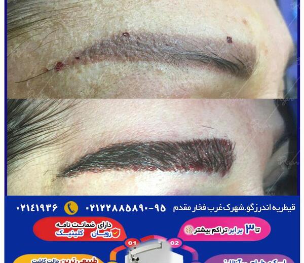 عکسهای کاشت طبیعی ابرو