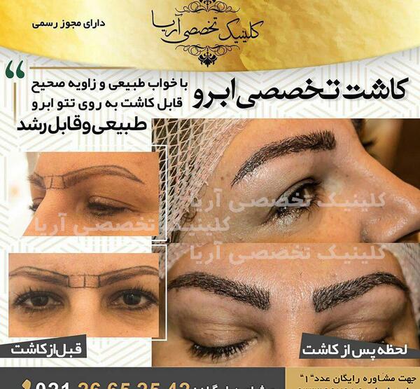 عکسهای کاشت طبیعی ابرو