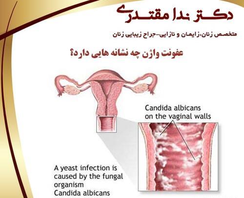 عکس عفونت داخل واژن