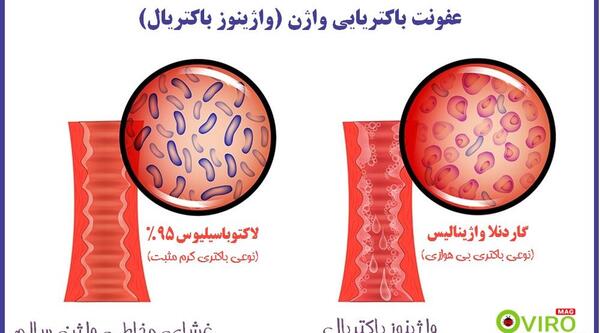 عکس عفونت داخل واژن