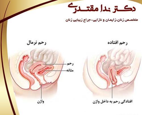 عکس عفونت داخل واژن