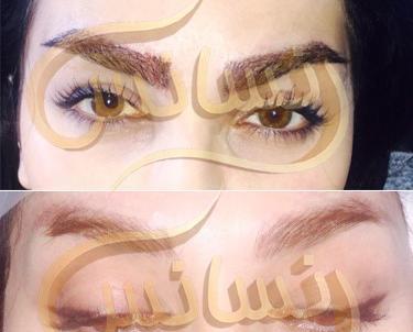 عکس کاشت ابرو