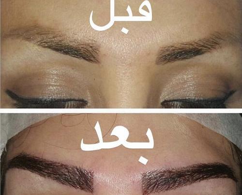 عکس کاشت ابرو